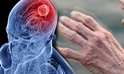 Parkinson Hastalığı